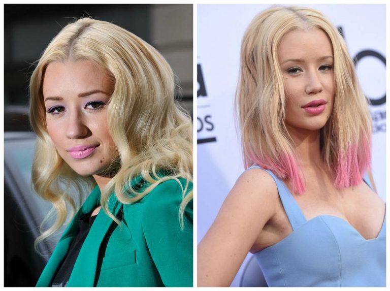 Iggy Azalea Before and After Pictures Hint She Has Undergone More ...